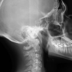 V Ostravě mají rentgen s rameny ve tvaru O. Zkracuje operaci i pobyt v nemocnici