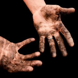 Epidemie žloutenky typu A: Případy v ČR raketově vzrostly